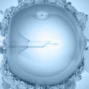 Zaprtje po prenosu zarodka (IVF)
